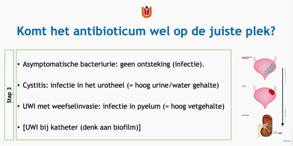 Hydrofiele en lipofiele antibiotica bij UWI